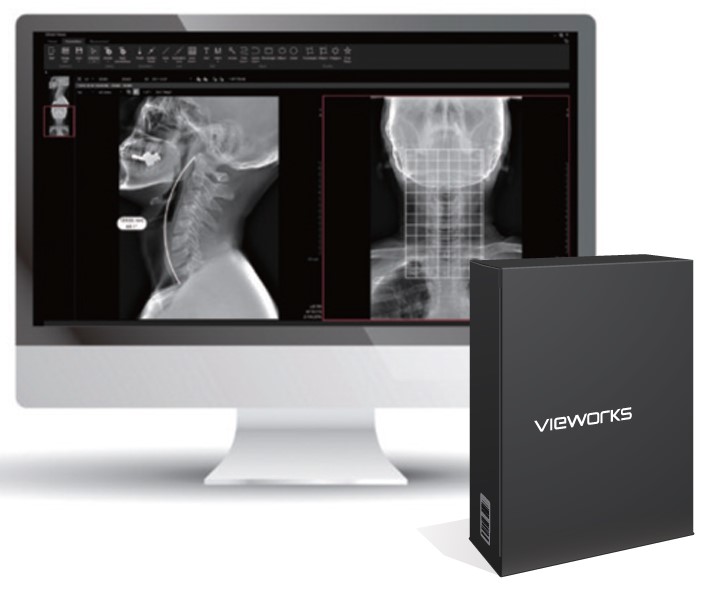 Vieworks Digital DR